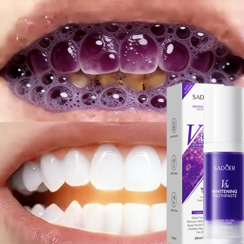 Teeth Whitening Effective - معجون أسنان مبيض الأكثر مبيعًا لعام