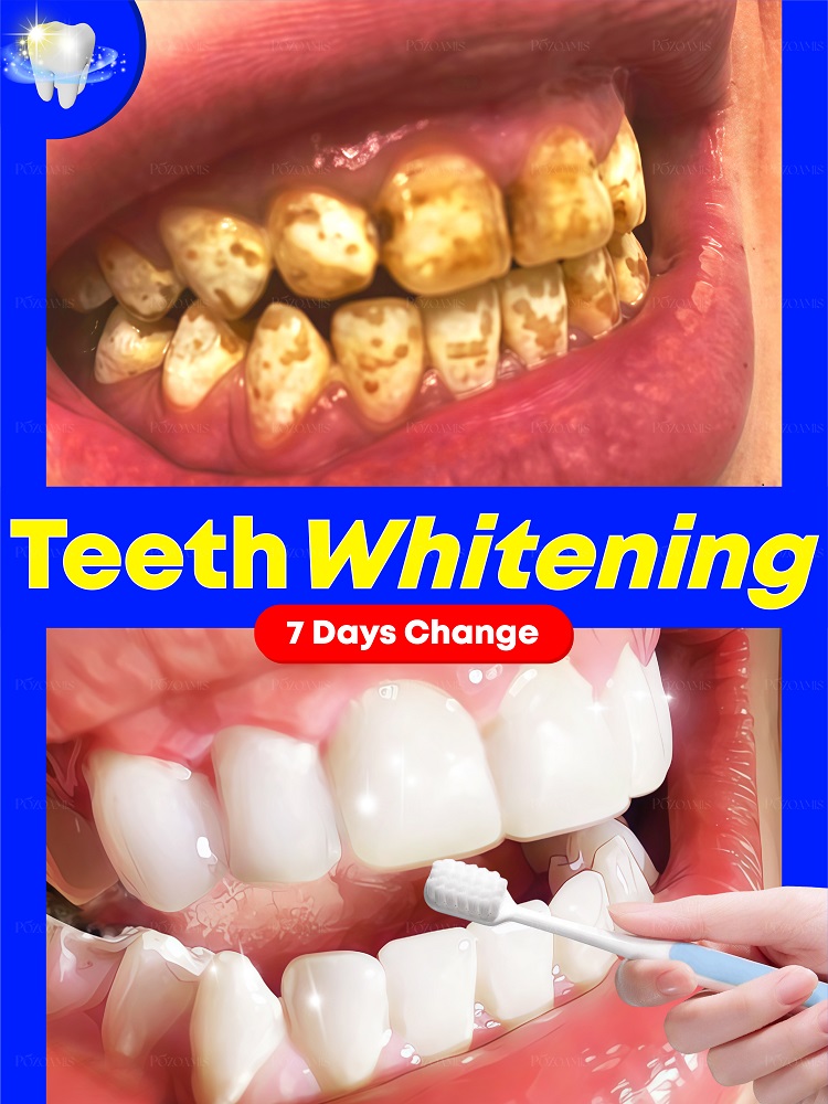 Teeth Whitening Effective - تكنولوجيا سوداء جديدة لعام 2025 لتبييض