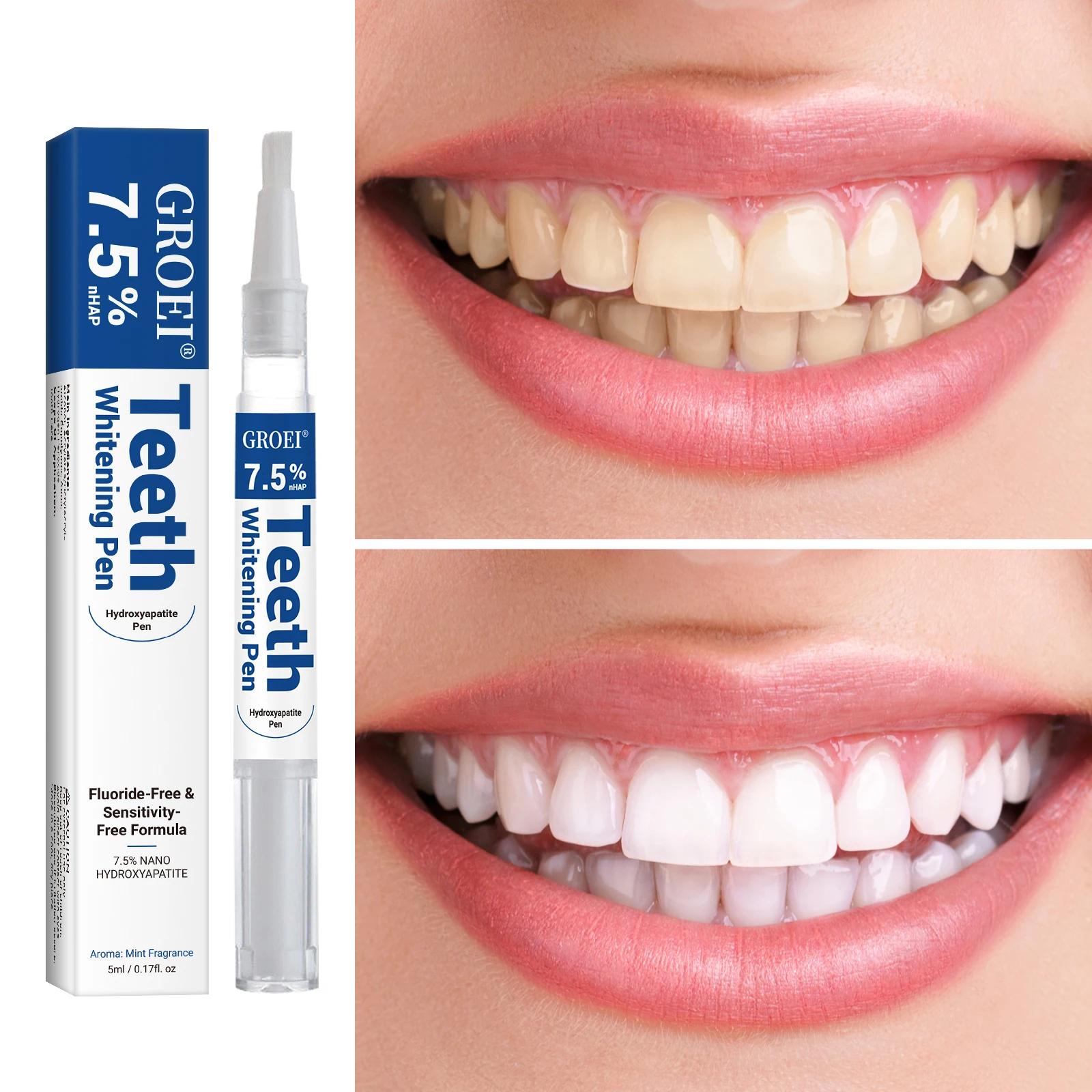هيدروكسياباتيت تبييض الأسنان ا - مراجعة Teeth Whitening Before And After وسعره