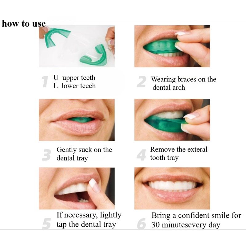 مجموعة صينية تبييض الأسنان على - مراجعة Teeth Whitening For Trays وسعره
