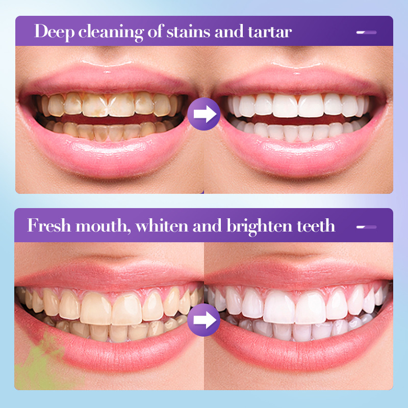معجون أسنان مبيض الأكثر مبيعًا - مراجعة Teeth Whitening Effective وسعره