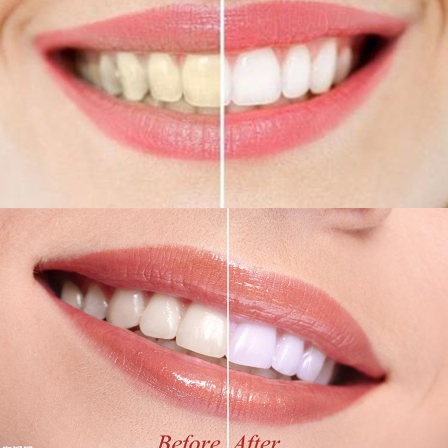 الخيزران الفحم الأسنان الأسنان - مراجعة Teeth Whitening Charcoal Powder وسعره