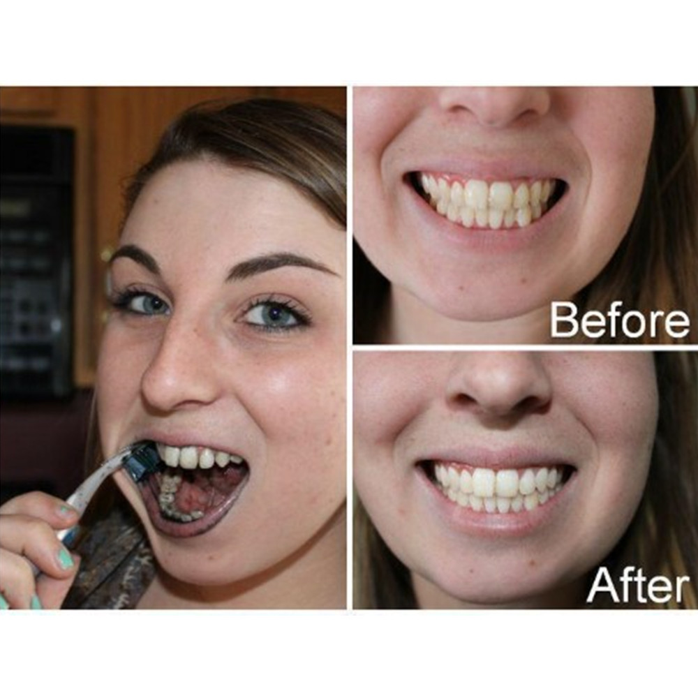 الخيزران الفحم الأسنان الأسنان - مراجعة Teeth Whitening Charcoal Powder وسعره
