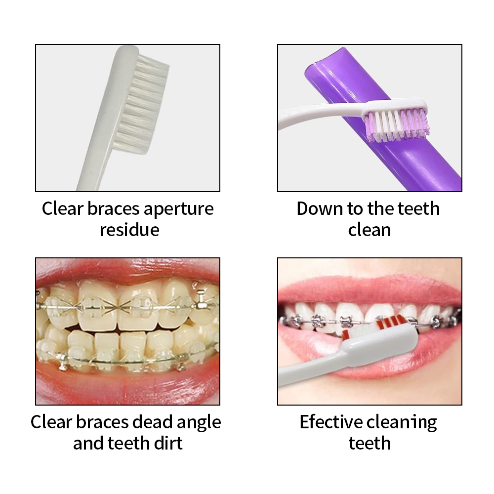 8 قطعة/المجموعة تقويم الأسنان  - مراجعة Teeth Whitening Brush وسعره