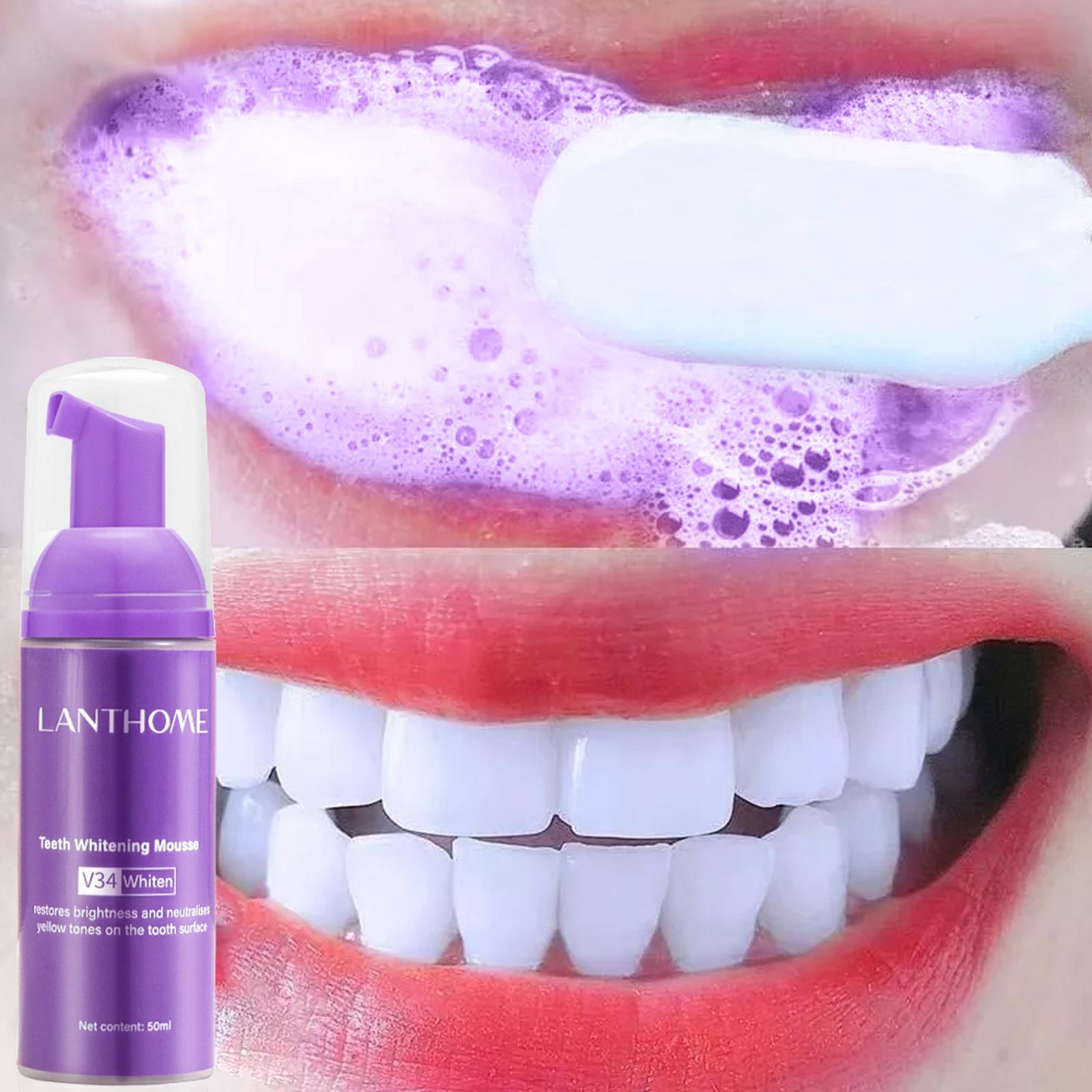 معجون أسنان V34 موس لتنظيف الأ - مراجعة Teeth Whitening Effective وسعره