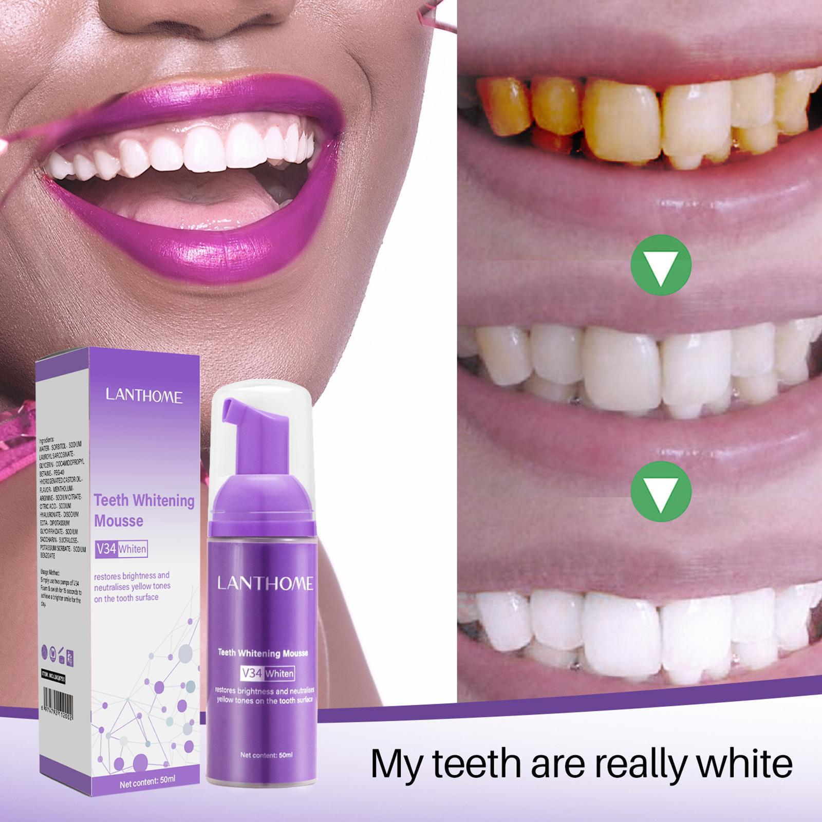 معجون أسنان V34 موس لتنظيف الأ - مراجعة Teeth Whitening Effective وسعره