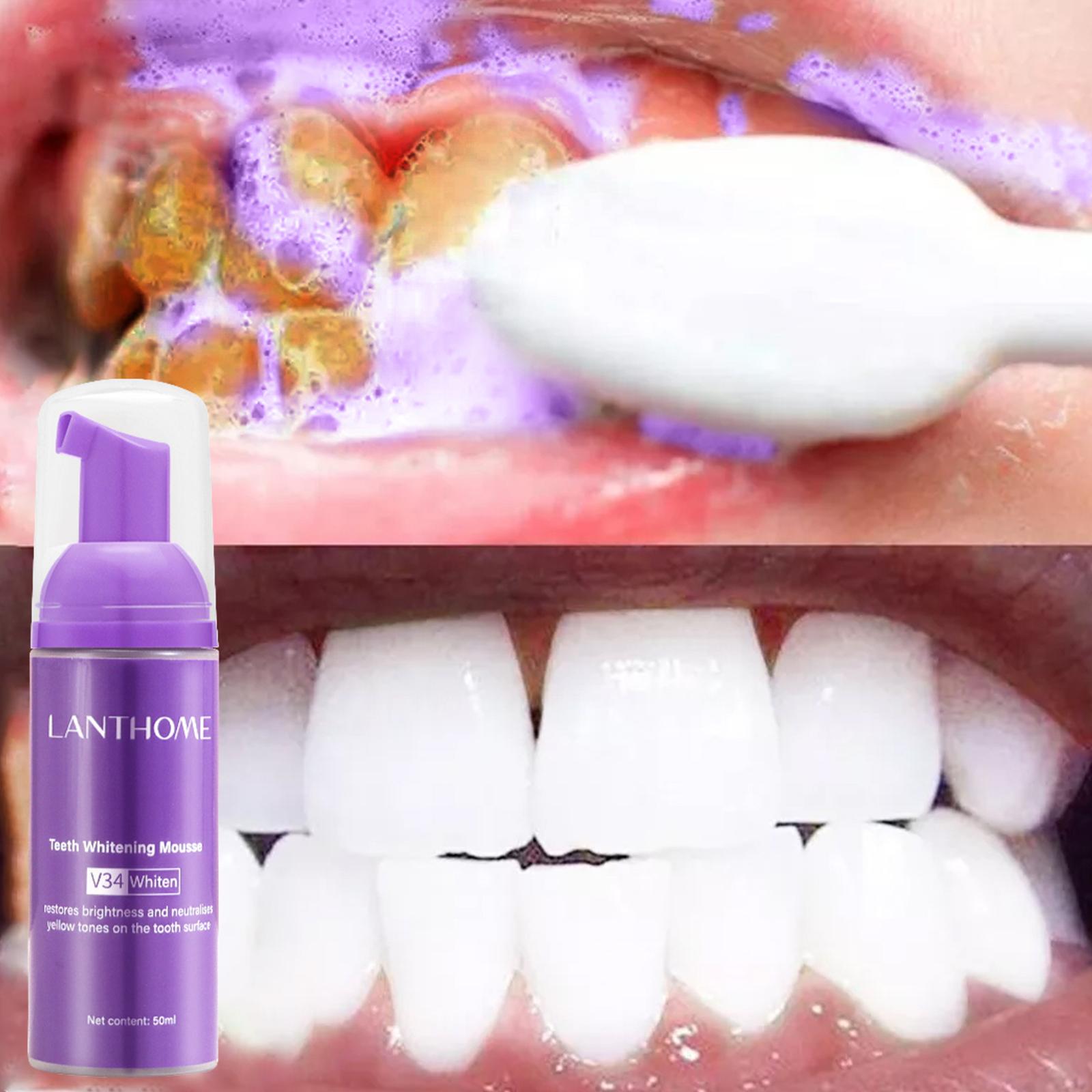 معجون أسنان V34 موس لتنظيف الأ - مراجعة Teeth Whitening Effective وسعره