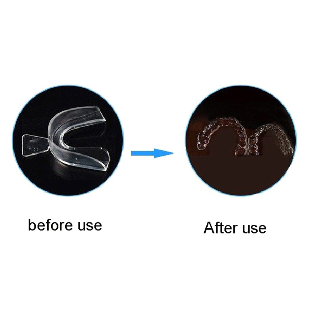 طقم تقويم أسنان ناعم 2/4 قطعة، - مراجعة Teeth Whitening For Trays وسعره