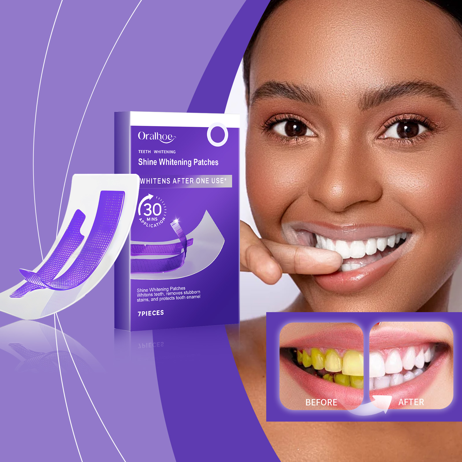 شرائط تبييض الأسنان باللون الأ - مراجعة Teeth Whitening/Bleaching وسعره