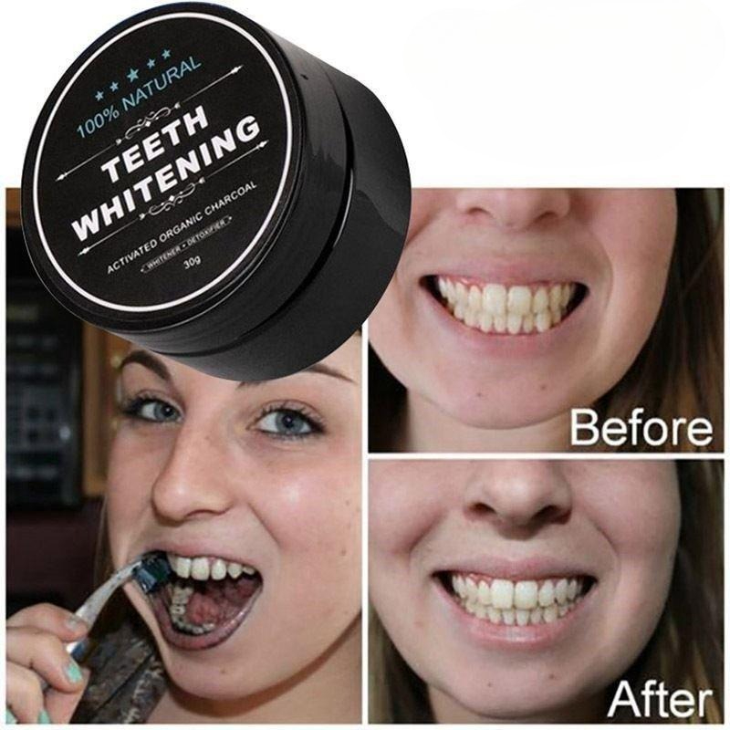 1 صندوق من مسحوق تبييض الأسنان - مراجعة Teeth Whitening Results وسعره