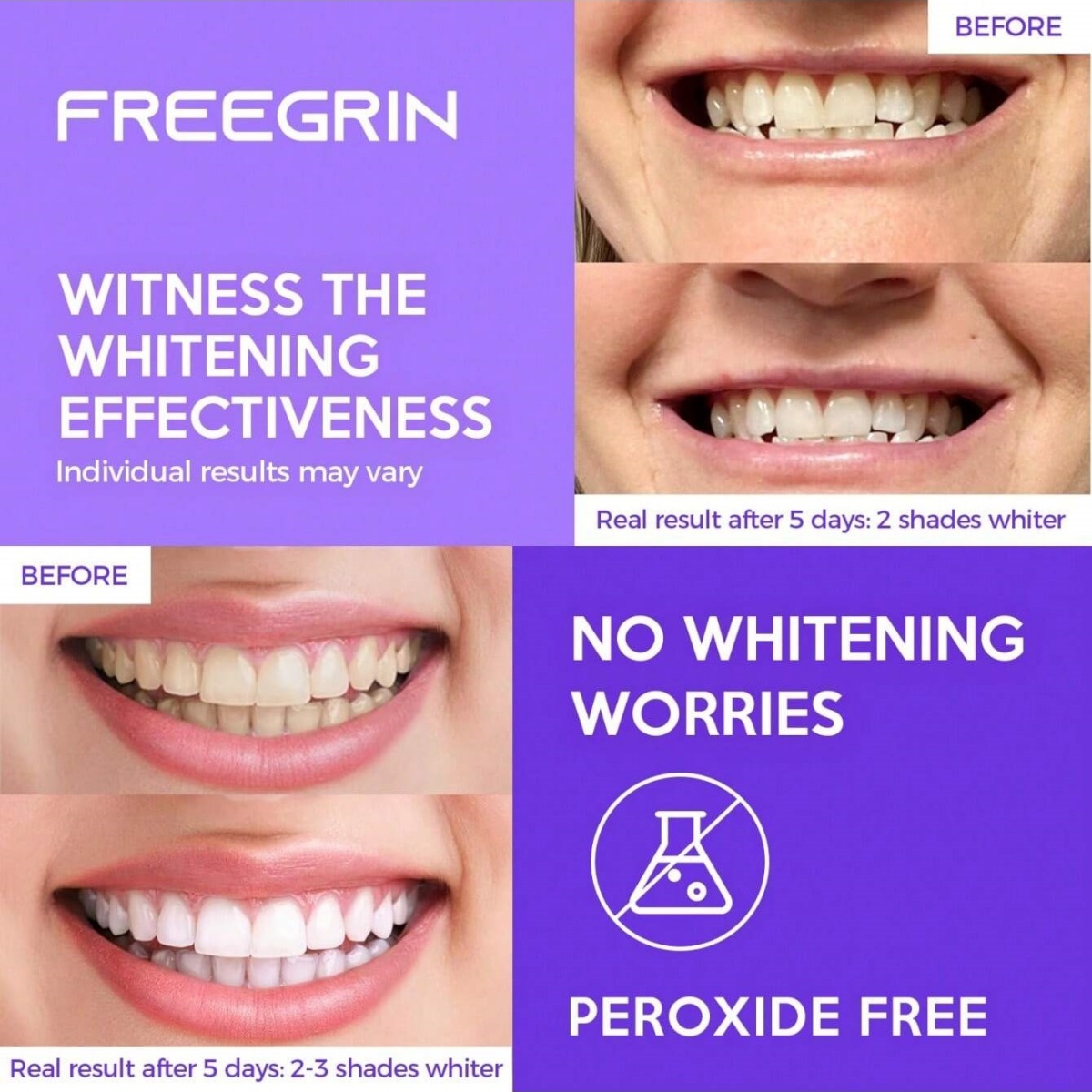 ديلوكس تبييض الأسنان ملصقات 7/ - مراجعة Teeth Whitening Before And After وسعره