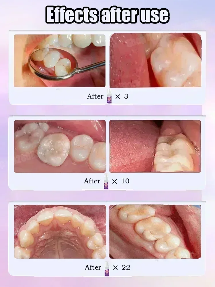 معجون أسنان لتنظيف الأسنان يزي - مراجعة Teeth Whitening Charcoal Powder وسعره