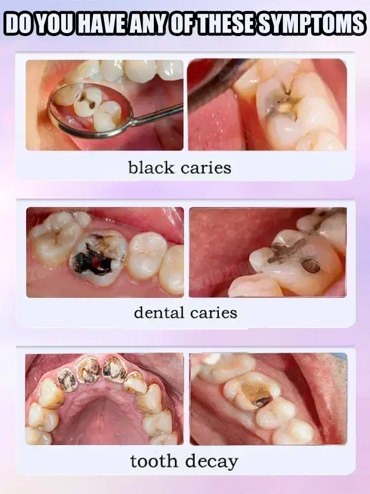 معجون أسنان لتنظيف الأسنان يزي - مراجعة Teeth Whitening Charcoal Powder وسعره