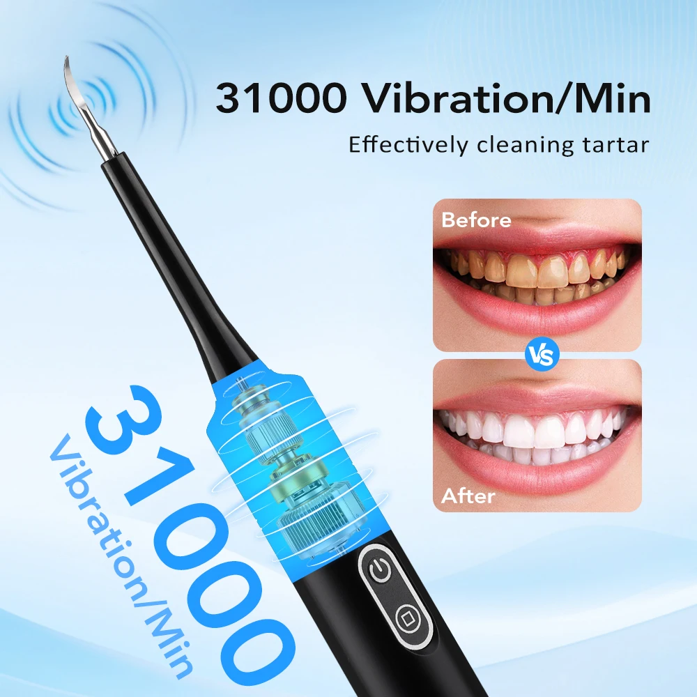 جهاز تنظيف الأسنان بالاهتزاز ا - مراجعة Teeth Whitening Kit Professional وسعره